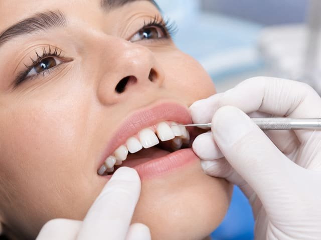 Diastema and gap closure treatment with Dr. Sawsan Awartani in Dubai